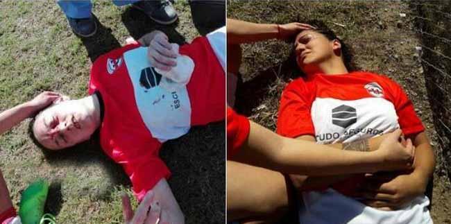 包含阿根廷女足队员受伤，将缺席下一场比赛的词条